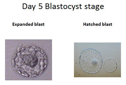 Day 5 Blastocyst stage