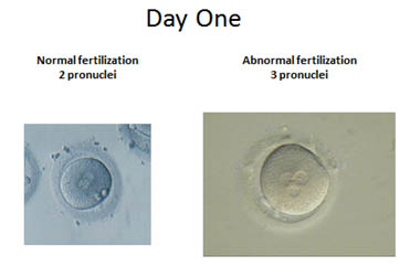 Day one fertilization photo